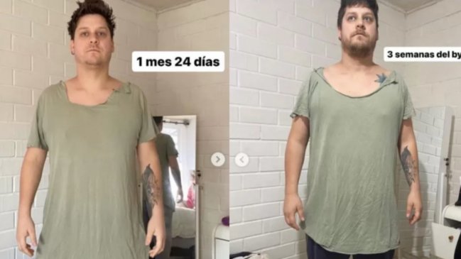 Exchico Yingo, Ariel Osses, revela complicaciones por cirugía bariática