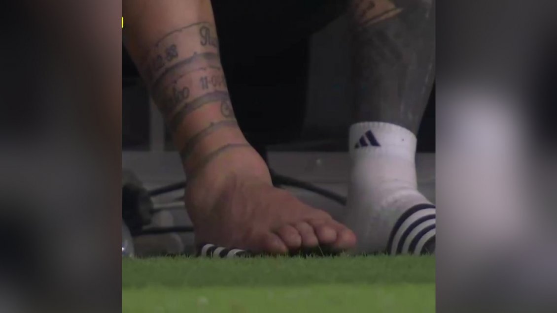 [VIDEO] ¡Impactante! Así luce el tobillo de Messi tras salir lesionado en la final de Copa América