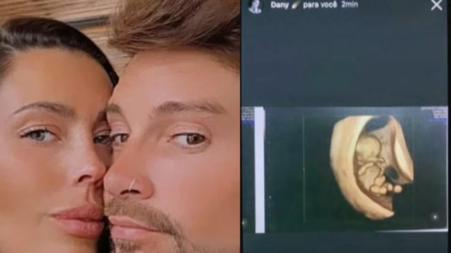 Luis Mateucci se pronunció sobre supuesta ecografía falsa de Daniela Aránguiz