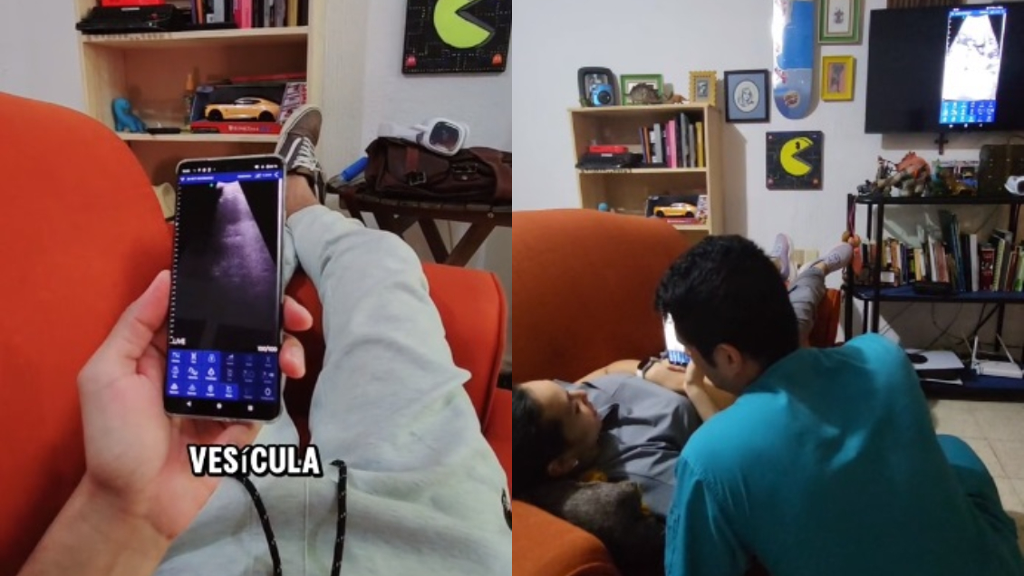 Médico descubrió embarazo de su esposa con un ultrasonido para el celular