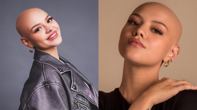 Isidora Carvallo: joven chilena con alopecia y diabetes es candidata a Miss Mundo Chile 2024
