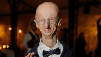   ¿Qué es la progeria, la enfermedad que padecía Sammy Basso? 