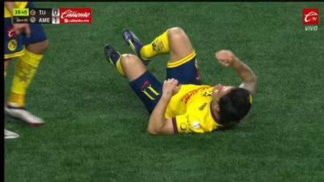 [VIDEO] La jugada que terminó con la dura lesión de Víctor Dávila