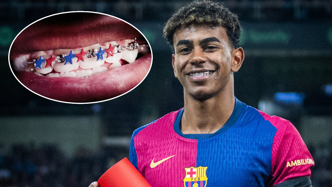 [FOTOS] Lamine Yamal usará brackets azulgrana en el clásico contra Real Madrid