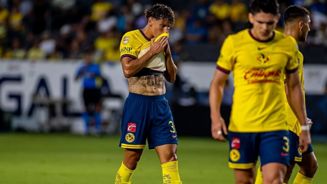 América definió el futuro de Igor Lichnovsky tras su grave lesión