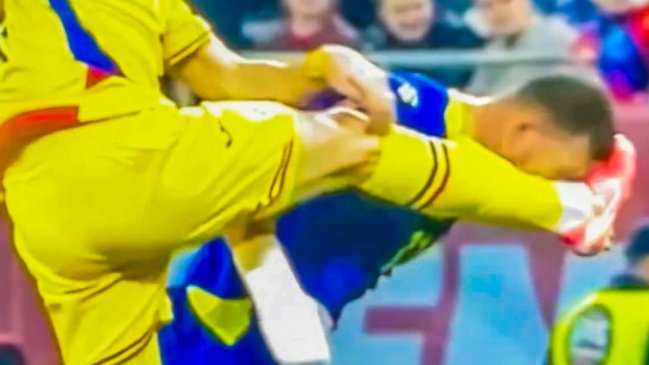 [VIDEO] Así quedó el rostro de Edin Dzeko tras brutal patada de un rival