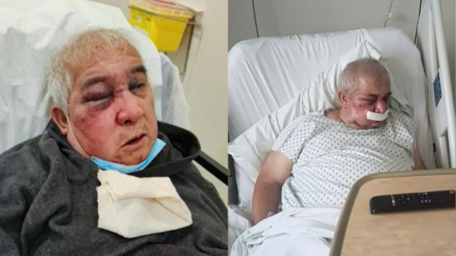 Denuncian brutal golpiza a conserje de 70 años en Vitacura
