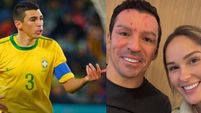 Lúcio mostró su primera foto sonriente y ya camina tras sufrir graves quemaduras