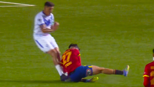 Joven Diego Robles sufrió lamentable lesión en su debut como titular con Unión Española