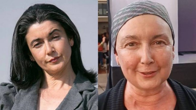 Paulina Urrutia detalla su proceso contra el cáncer de mama: 