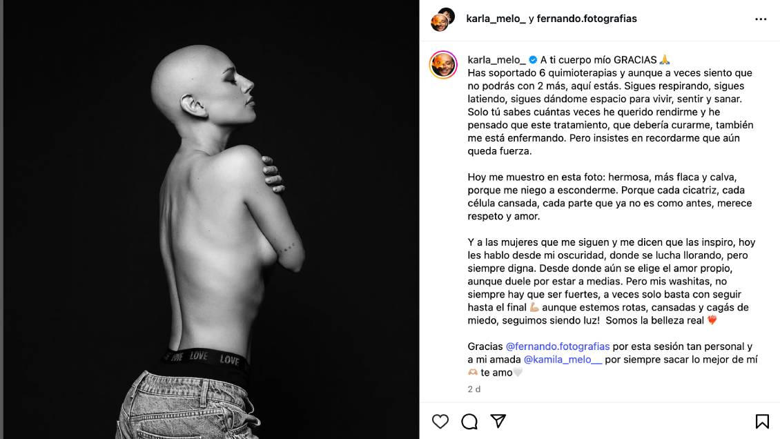 Karla Melo compartió emotiva reflexión tras sexta quimioterapia