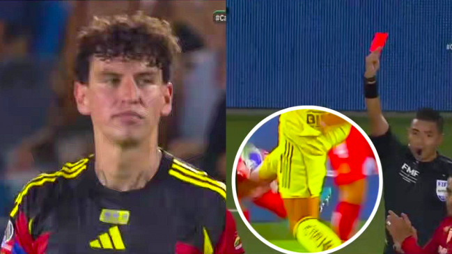 Lichnovsky fue expulsado en la caída de América ante Toluca por el Campeón de Campeones