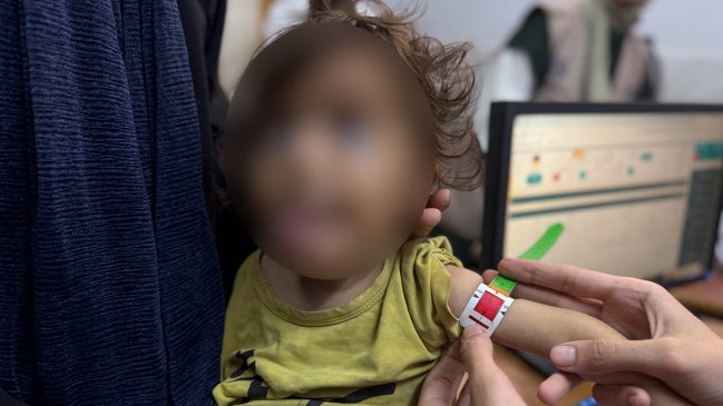 Gaza registra 10 nuevas muertes por desnutrición en las últimas 24 horas