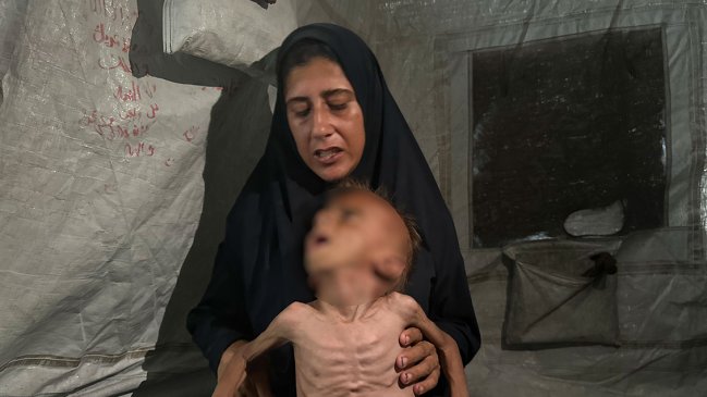 Guagua de seis meses murió por desnutrición en Gaza