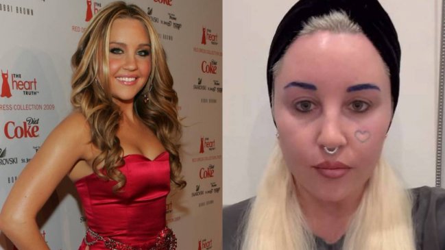 Amanda Bynes, exactriz infantil, muestra su nueva apariencia tras retoque estético
