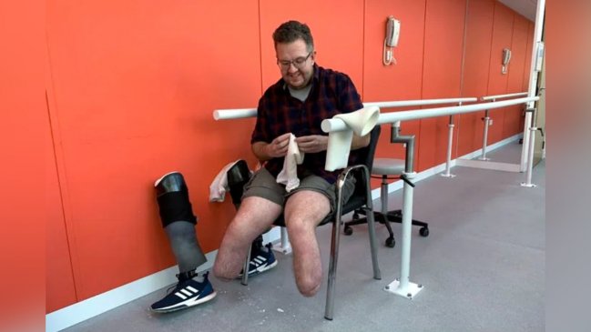 Médico se hizo amputar las piernas para cobrar seguro y satisfacer perversión sexual