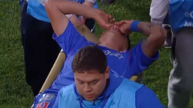 Matías Sepúlveda salió lesionado del duelo entre la U y Alianza Lima en la Sudamericana