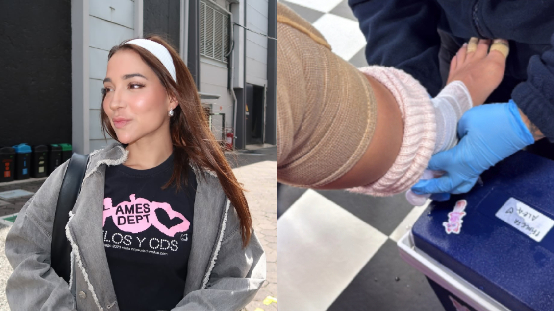 Princesa Alba sufre lesión durante ensayos de 