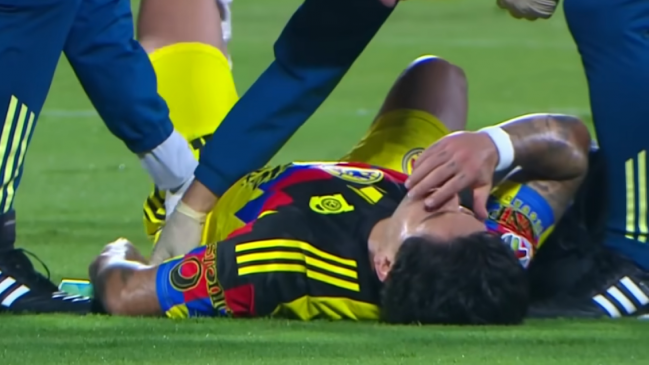 Víctor Dávila se lesionó en la derrota de Club América ante Cruz Azul