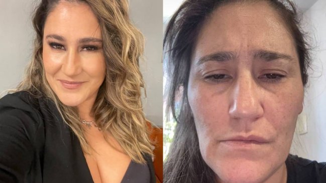 Belén Mora revela complejo problema de salud: "Pensé que iba a morir"