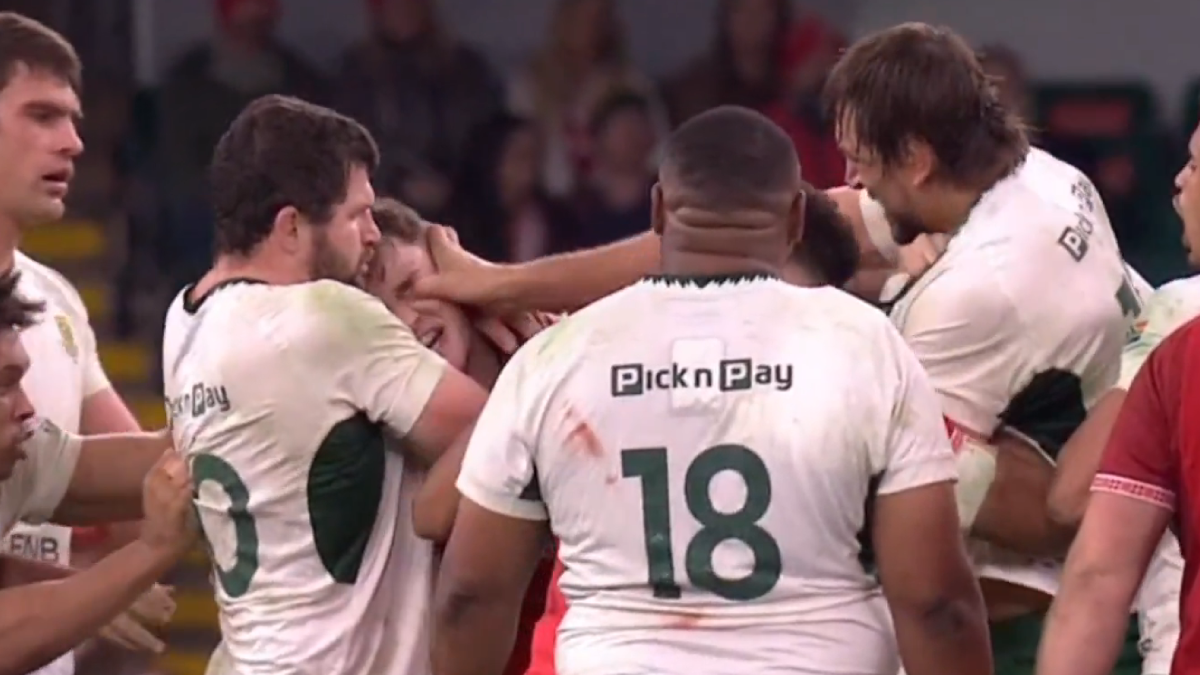 [VIDEO] Histórico del rugby sudafricano dio brutal dedazo en el ojo a ...