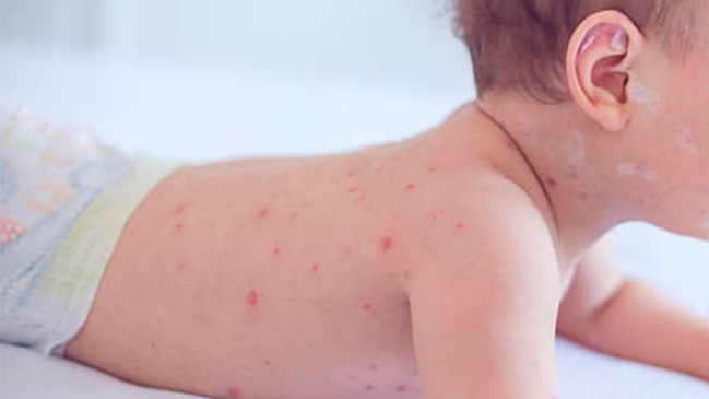 Imagen foto_00000004