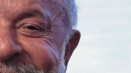 Lula fue operado con éxito de cataratas