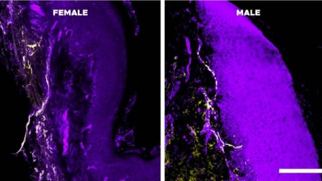 El sistema inmunitario, la causa de que el dolor crónico dure más en las mujeres