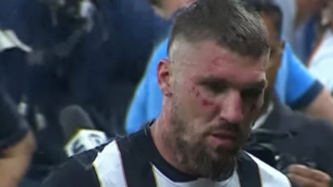   [VIDEO] Jugador de Atlético Mineiro fue golpeado por siete futbolistas distintos durante gresca en Brasil 