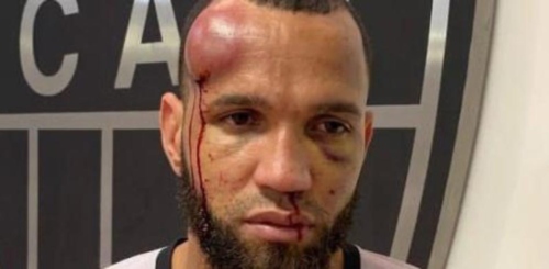 Imagen foto_00000014