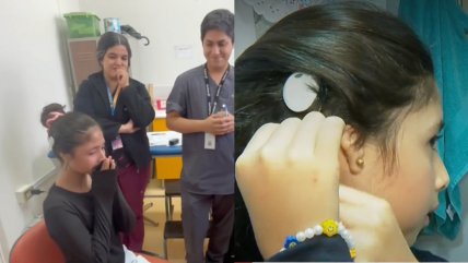   Escuchó la lluvia: Niña recibió el primer implante de conducción ósea del sistema público 