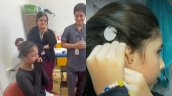Escuchó la lluvia: Niña recibió el primer implante de conducción ósea del sistema público