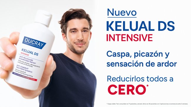 Llega a Chile eficaz tratamiento dermatológico para la caspa severa