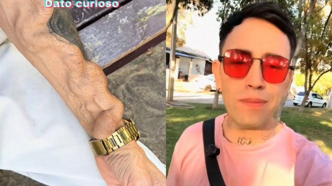 Joven terminó con secuelas en el brazo tras extraerse una muela infectada