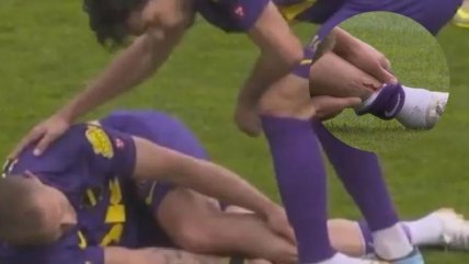   [VIDEO] Imágenes sensibles: Brutal lesión en la Eredivisie encendió el debate por las 