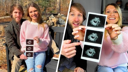   Youtuber recibió ola de críticas tras revelar aborto por diagnóstico de síndrome de Down 