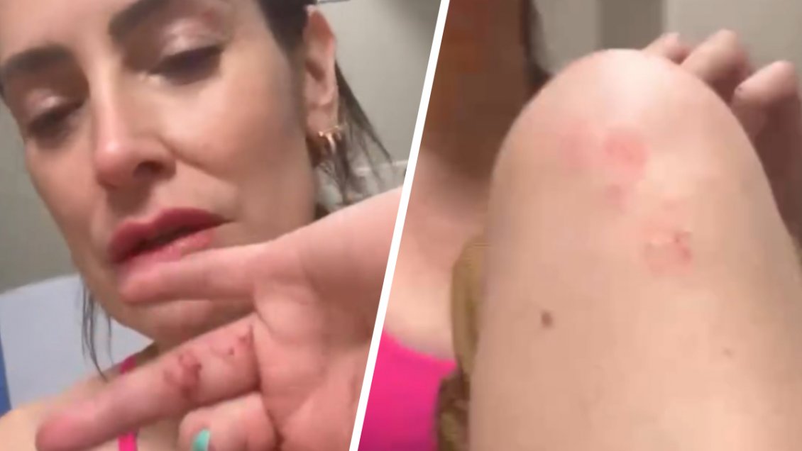 Adriana Barrientos sufrió violento portonazo en Las Condes
