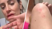 Adriana Barrientos sufrió violento portonazo en Las Condes