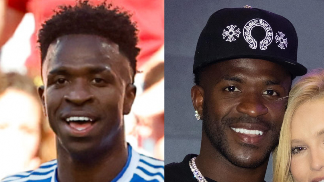 Irreconocible: Vinícius Júnior se realizó una cirugía estética de mentón tras el Mundial 2026