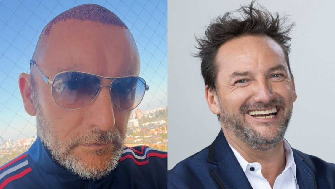 Daniel Fuenzalida sorprendió con cambio de look para someterse a popular tratamiento
