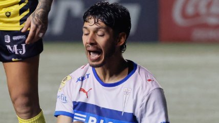   Jimmy Martínez se sumó a la lista de bajas en la UC para el duelo ante La Calera 