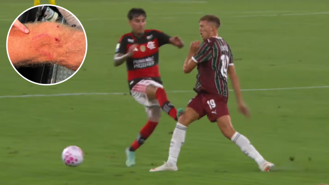 Fluminense estalló por polémica falta de Erick Pulgar: 